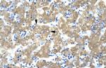 ACAT2 Polyclonal Antibody