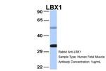 LBX1 Polyclonal Antibody