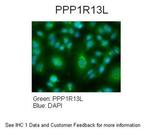 PPP1R13L Polyclonal Antibody