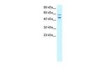 Vasculin Antibody in Western Blot (WB)