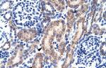 RBAK Antibody in Immunohistochemistry (IHC)