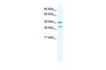 Nkx2.3 Antibody in Western Blot (WB)