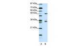 PHF1 Antibody in Western Blot (WB)