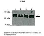 PLD2 Antibody in Western Blot (WB)