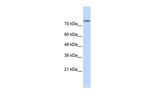 PLD2 Antibody in Western Blot (WB)