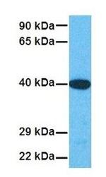 SOX18 Antibody in Western Blot (WB)