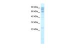 SLC38A2 Antibody in Western Blot (WB)