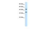 PNMA1 Antibody in Western Blot (WB)