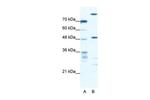 NFS1 Polyclonal Antibody