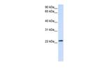RAB18 Polyclonal Antibody