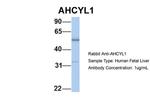 AdoHcyase 2 Polyclonal Antibody