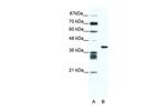 ALX4 Polyclonal Antibody