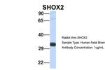 SHOX2 Antibody in Western Blot (WB)