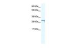 SHOX2 Antibody in Western Blot (WB)