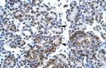 SPT5 Polyclonal Antibody