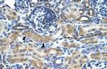 ZNF24 Antibody in Immunohistochemistry (IHC)