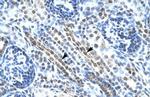 ANKRD11 Polyclonal Antibody