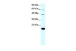 Claudin 23 Antibody in Western Blot (WB)