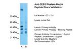 ZEB2 Antibody in Western Blot (WB)