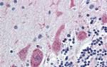 ST18 Antibody in Immunohistochemistry (IHC)