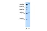 NFE2L3 Polyclonal Antibody