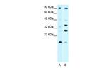 KIF3B Polyclonal Antibody
