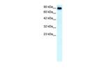 SLC4A1 Polyclonal Antibody