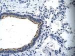 ASGR2 Antibody in Immunohistochemistry (Paraffin) (IHC (P))