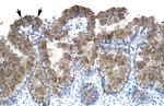 ASGR2 Polyclonal Antibody
