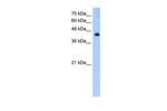 ACADL Polyclonal Antibody