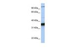 KIFC3 Polyclonal Antibody