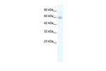 MTG16 Polyclonal Antibody