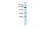 BRD8 Polyclonal Antibody