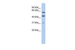 ZNF179 Polyclonal Antibody