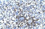 RCOR3 Polyclonal Antibody