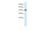 TMEM259 Antibody in Western Blot (WB)