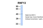 RNF13 Polyclonal Antibody