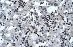 SMARCB1 Antibody in Immunohistochemistry (Paraffin) (IHC (P))