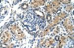 TIMELESS Polyclonal Antibody