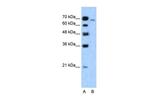 Afadin Polyclonal Antibody