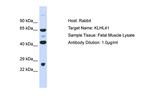 KLHL41 Polyclonal Antibody