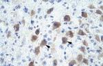 PAX9 Polyclonal Antibody