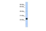 GTL3 Polyclonal Antibody