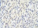 SAP30BP Polyclonal Antibody