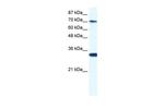 CNOT3 Polyclonal Antibody