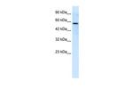 RIPX Polyclonal Antibody