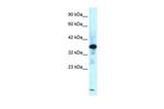 ZFPL1 Antibody in Western Blot (WB)