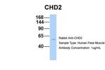CHD2 Polyclonal Antibody