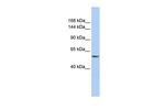 CHD2 Antibody in Western Blot (WB)