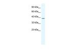 ELK4 Polyclonal Antibody